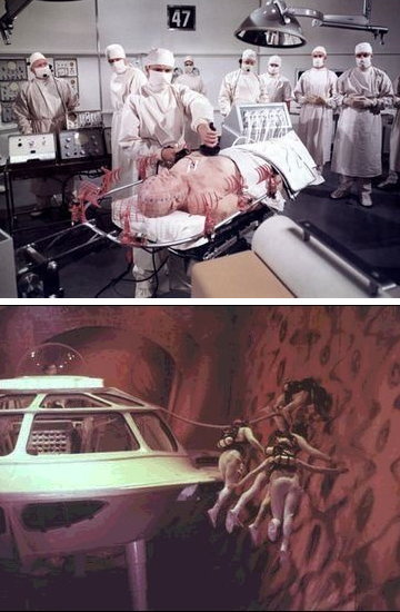 がん治療に「ミクロの決死圏」